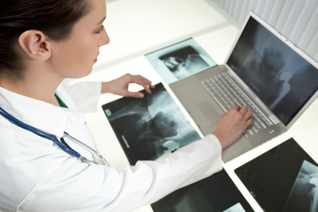 Surgeon Reviewing X-Rays of Depuy Pinnacle Artificial Hip